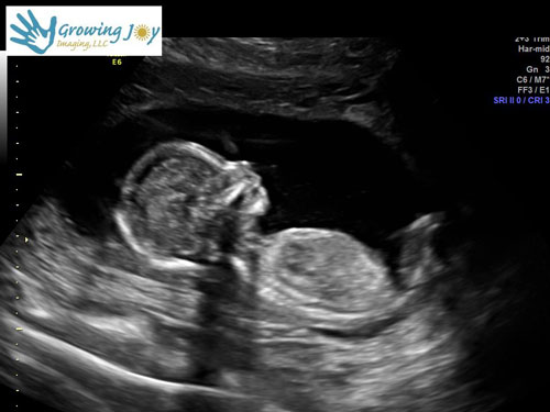 OB Diagnostic Ultrasound 20211023 image 07